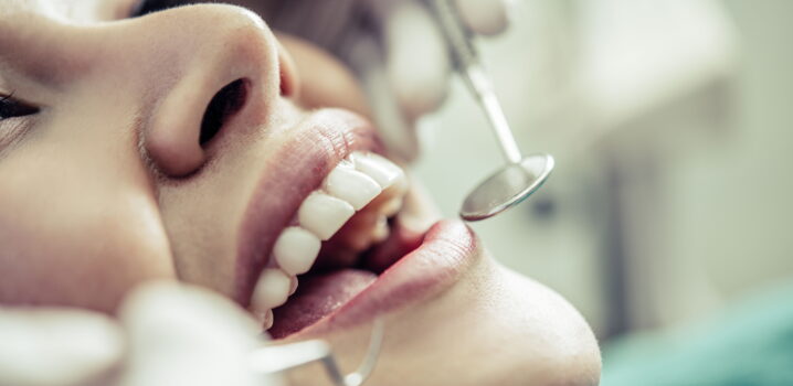 Orçamento odontológico: como estruturar e apresentar ao paciente 